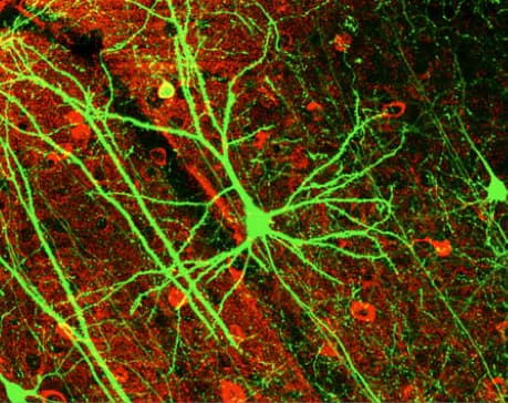 Bright green branches at the end of a nerve cell, against a red background.